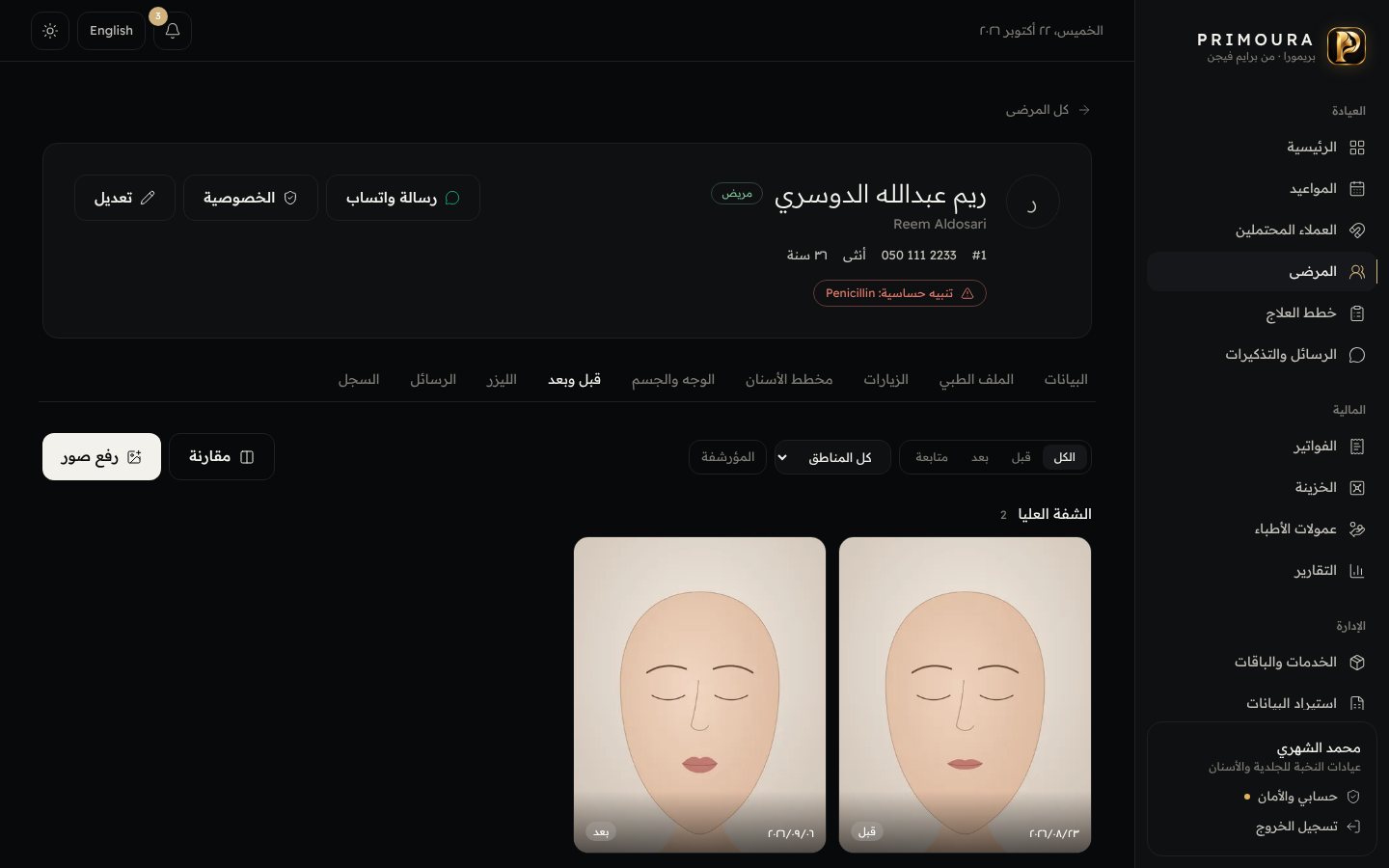التجميل