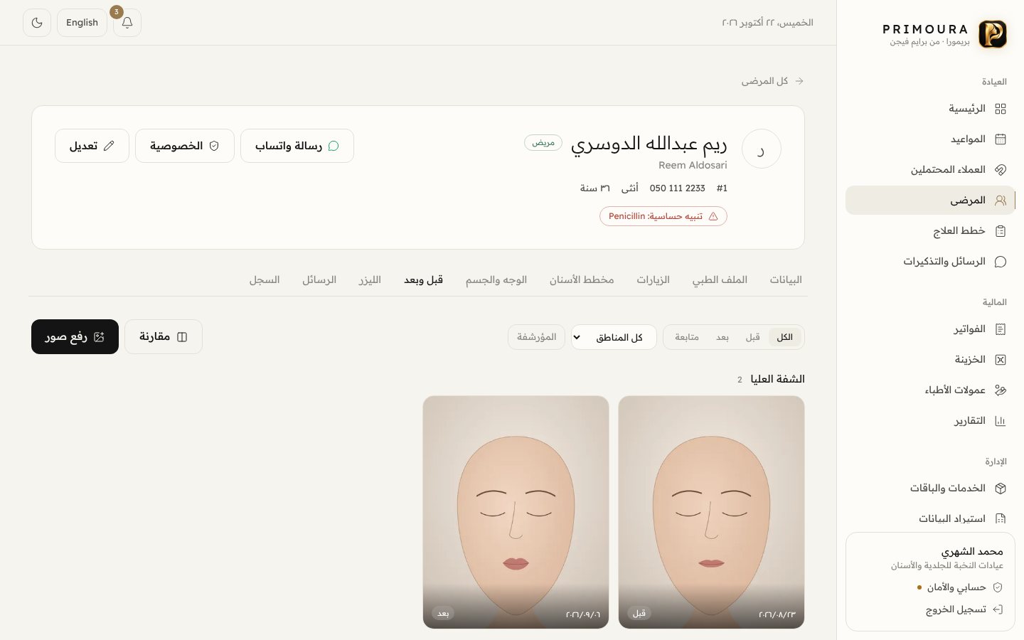 التجميل